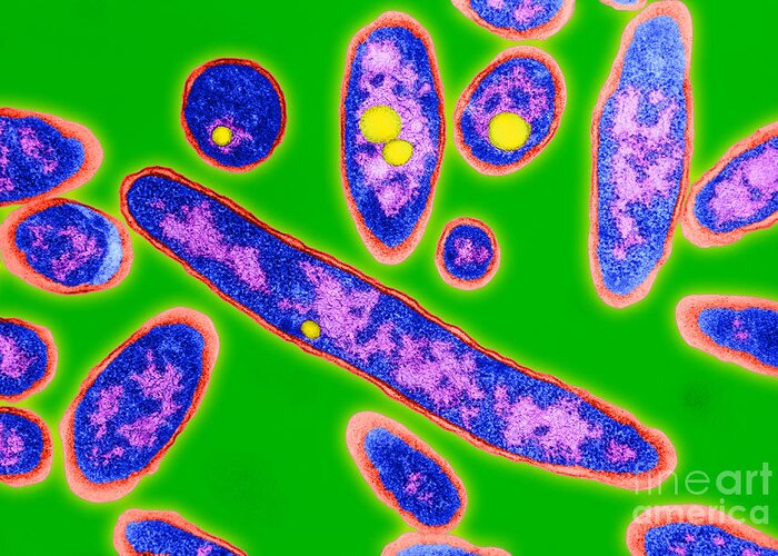 Bacteria Greeting Card featuring the photograph Legionnaires Disease Bacteria by Science Source