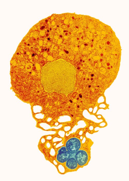 Neisseria Gonorrhoeae Greeting Card featuring the photograph Neutrophil And Trapped Bacteria, Tem by 