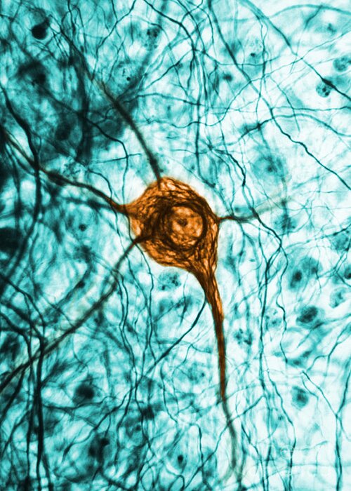 Cell Greeting Card featuring the photograph Neuron, Tem #1 by Science Source