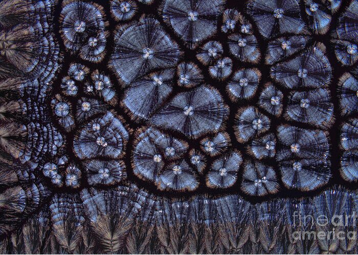 Atherosclerosis Greeting Card featuring the photograph Cholesterol Crystals, Polarized Lm #3 by Antonio Romero