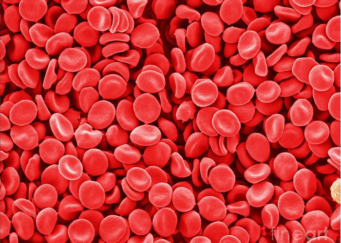 Red Blood Cells Greeting Card featuring the photograph Red Blood Cells, Sem #4 by Scimat