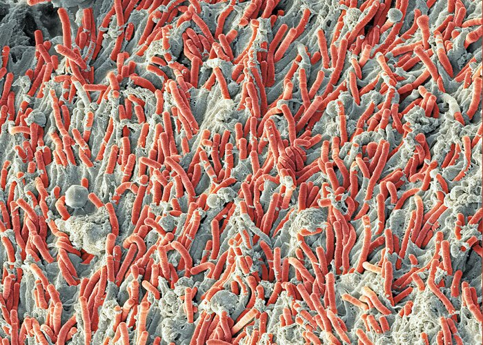 Fusobacterium Greeting Card featuring the photograph Dental Plaque, Sem #7 by Steve Gschmeissner