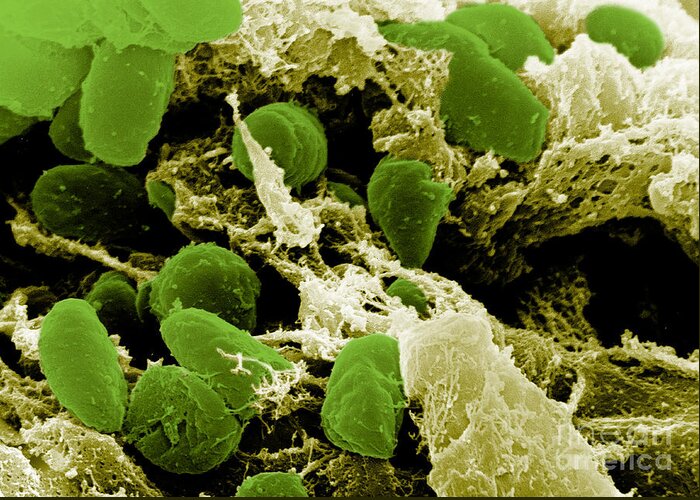 Microbiology Greeting Card featuring the photograph Yersinia Pestis Bacteria, Sem #7 by Science Source