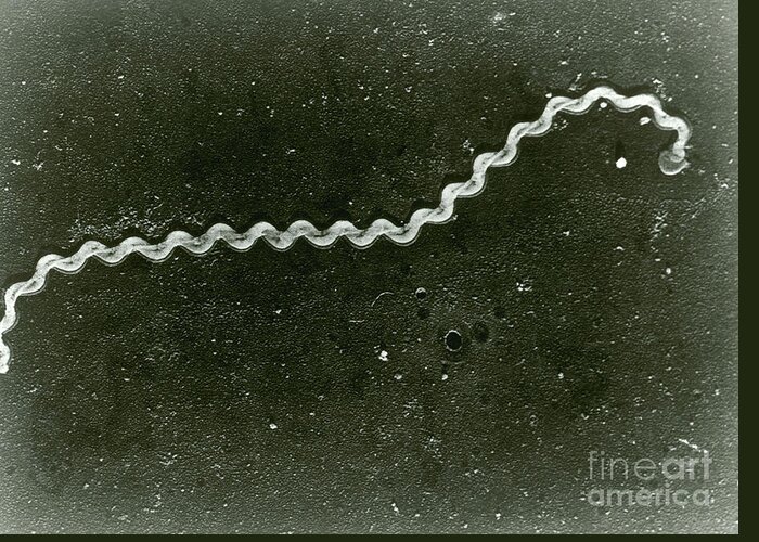 Science Greeting Card featuring the photograph Leptospira, Sem by Omikron
