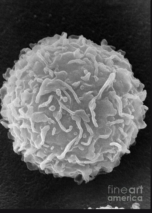 Biology Greeting Card featuring the photograph Mast Cell SEM by Don Fawcett and E Shelton and Photo Researchers