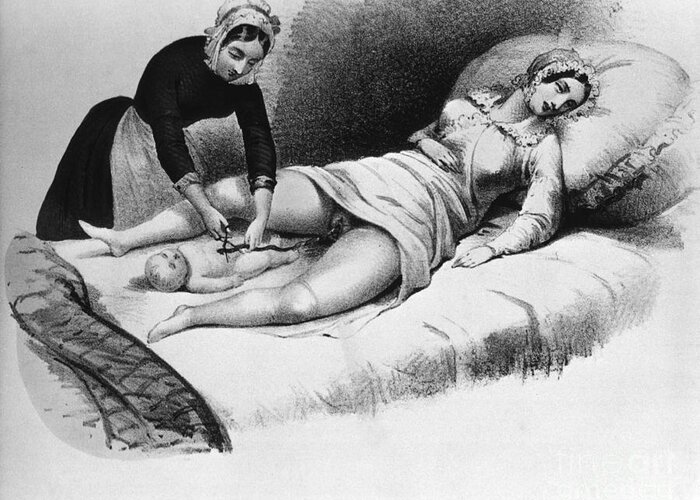 History Greeting Card featuring the photograph Midwife Cutting Umbilical Cord, 1850 by Science Source