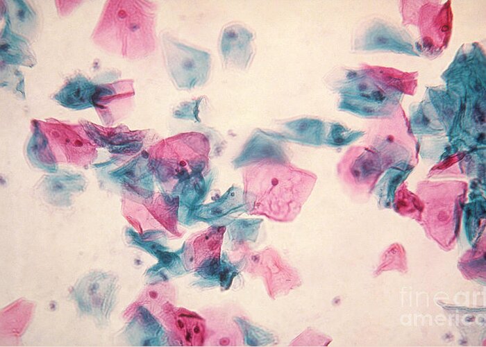 Medical Greeting Card featuring the photograph Pap Smear by Science Source
