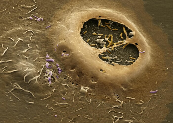 Bacteria Greeting Card featuring the photograph Coxiella Burnetii Sem #8 by Meckes/ottawa