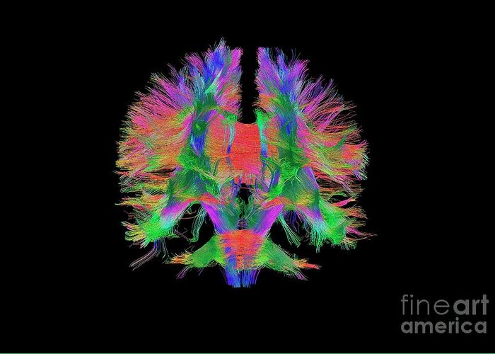 Brain Greeting Card featuring the photograph Brain Fibres Front View by Do Tromp/science Photo Library