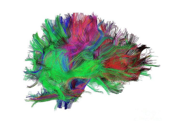 Brain Greeting Card featuring the photograph Brain Fibres Side View Right by Do Tromp/science Photo Library
