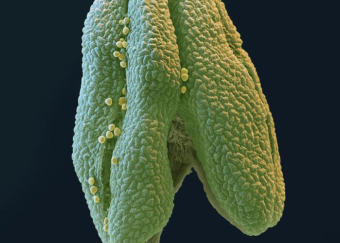 Allergen Greeting Card featuring the photograph Linden Pollen, Sem by Oliver Meckes EYE OF SCIENCE
