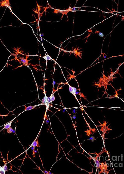 Actin Greeting Card featuring the photograph Neurons From Stem Cells by Dr Torsten Wittmann/science Photo Library