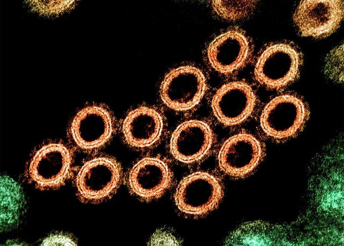 Nobody Greeting Card featuring the photograph Swine Flu Virus by Niaid/science Photo Library