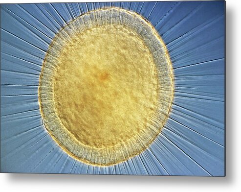 Actinopod Metal Print featuring the photograph Actinosphaerium Heliozoan #1 by Rogelio Moreno/science Photo Library