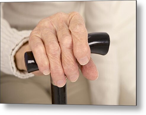 Arthritis Metal Print featuring the photograph Arthritic hand and walking stick by Science Photo Library