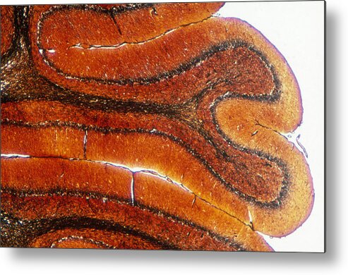 Brain Metal Print featuring the photograph Cerebellum Purkinje Cells, Lm by Michael Abbey