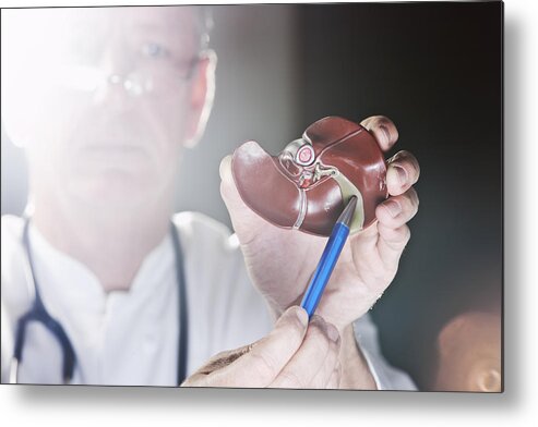 Gall Stone Metal Print featuring the photograph Doctor pointing at gall bladder by Jan-Otto