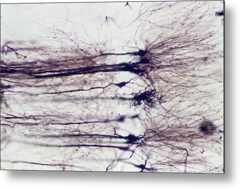 Anatomical Metal Print featuring the photograph Nerve Cells by Overseas/collection Cnri/spl