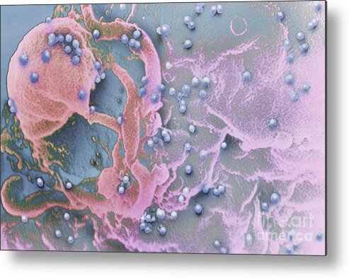 Aids Metal Print featuring the photograph Aids Viruses #1 by Science Source