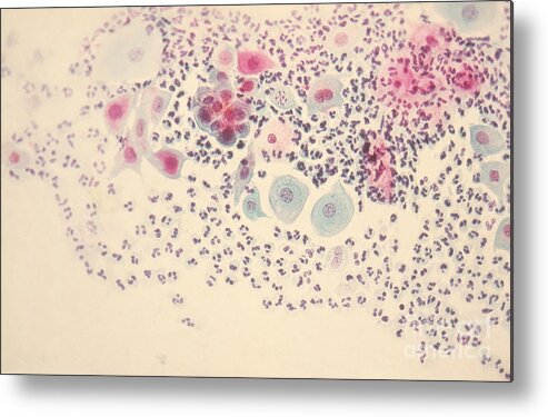 Cytology Smear Metal Print featuring the photograph Normal Stellate Cells by Science Source