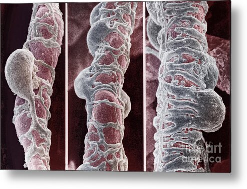 Blood Metal Print featuring the photograph Pericytes by Science Source