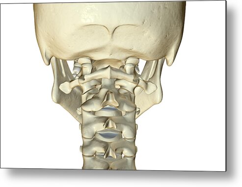 Horizontal Metal Print featuring the digital art The Bones Of The Neck by MedicalRF.com