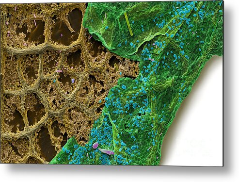 Diatom Metal Print featuring the photograph Diatoms Eating A Maple Leaf by Ted Kinsman