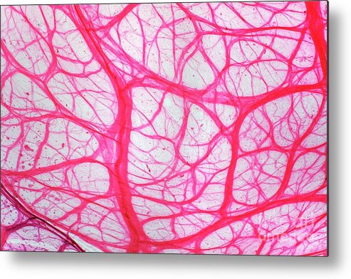 Tissue Metal Print featuring the photograph Bladder Tissue by Dr Keith Wheeler/science Photo Library