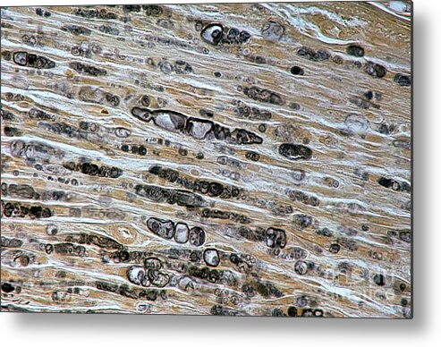 Axon Metal Print featuring the photograph Damaged Myelinated Fibres #1 by Jose Calvo / Science Photo Library
