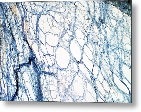 Tissue Metal Print featuring the photograph Areolar Connective Tissue by Choksawatdikorn / Science Photo Library