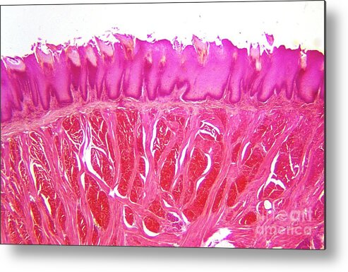 Tongue Metal Print featuring the photograph Lm Of Section Through Human Tongue by John Burbidge/science Photo Library