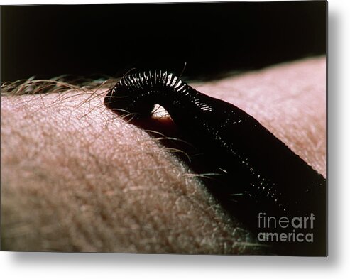Medicinal Leech Sucking Blood From Human Skin Metal Print by Geoff  Tompkinson/science Photo Library - Pixels Merch