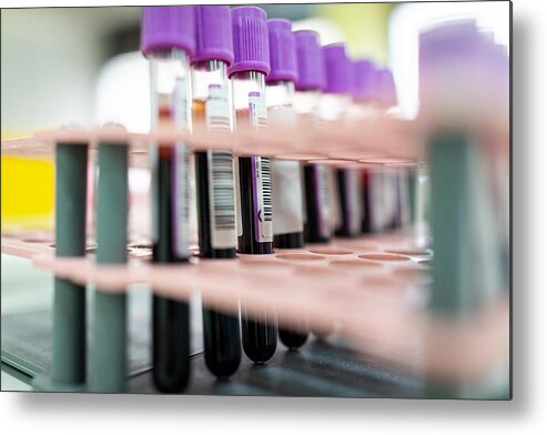 Medical Test Metal Print featuring the photograph Laboratory result with blood tubes by Jasmin Merdan