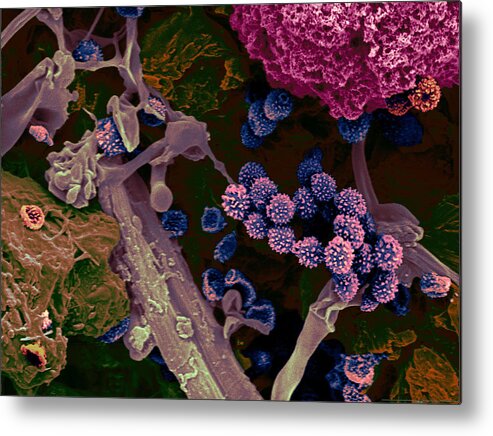 Fungus Metal Print featuring the photograph Dark Ceiling Mold, Sem #1 by Scimat