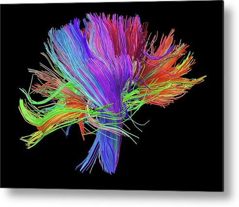 Brain Scan Metal Print featuring the photograph White Matter Fibres Of The Human Brain by Alfred Pasieka