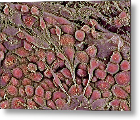 Embryonic Stem Cell Metal Print featuring the photograph Embryonic Stem Cells by Professor Miodrag Stojkovic/science Photo Library