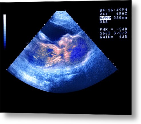 People Metal Print featuring the photograph IVF baby scan by Peter Dazeley