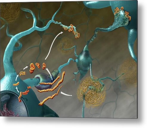 Disease Metal Print featuring the photograph Prions In Brain Disease by Nicolle R. Fuller