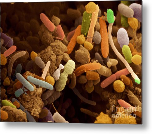 Human Metal Print featuring the photograph Bacteria In Human Feces, Sem by Scimat
