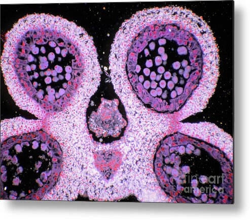 Anther Metal Print featuring the photograph Section Through A Lily Anther With Pollen by Astrid & Hanns-frieder Michler/science Photo Library