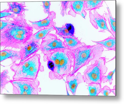 Cell Metal Print featuring the photograph Cells Stained For Proteins #1 by Kevin Mackenzie / University Of Aberdeen / Science Photo Library