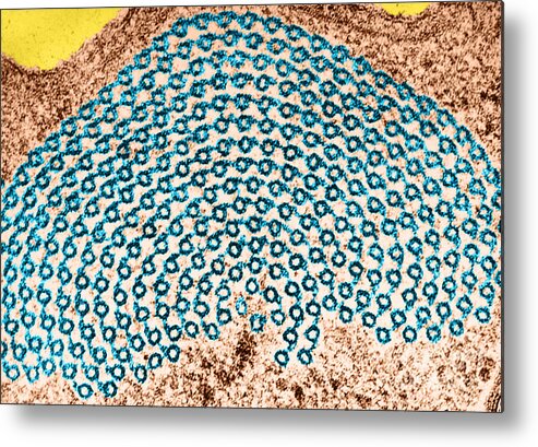 Histology Metal Print featuring the photograph Tem Of Microtubules In Echinosphaerium #1 by Biology Pics