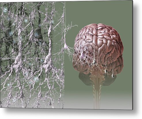 Alzheimer's Disease Metal Print featuring the photograph Alzheimer's Disease #3 by Hans-ulrich Osterwalder