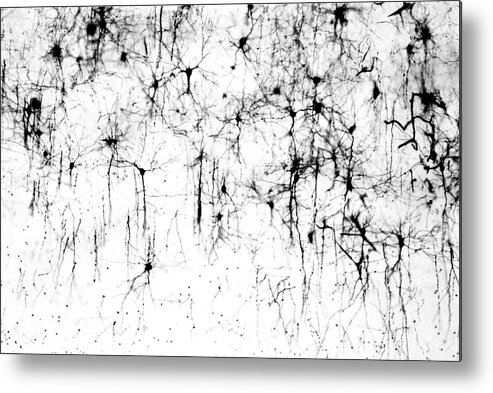 Anatomy Metal Print featuring the photograph Cerebral Cortex Nerve Cells by Secchi-lecaque/roussel-uclaf/cnri/science Photo Library