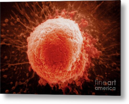 Science Metal Print featuring the photograph Macrophage Sem by Dr. Cecil H. Fox