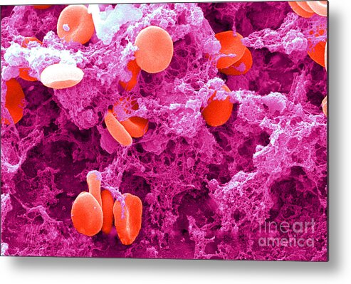 Biology Metal Print featuring the photograph Red Blood Cells, Sem #31 by Science Source