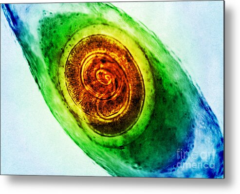 Biology Metal Print featuring the photograph Trichinella In Muscle Lm #5 by Omikron