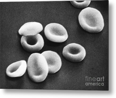 Sem Metal Print featuring the photograph Red Blood Cells, Sem #8 by Omikron