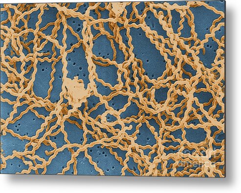 Spirochete Metal Print featuring the photograph Leptospira by Science Source