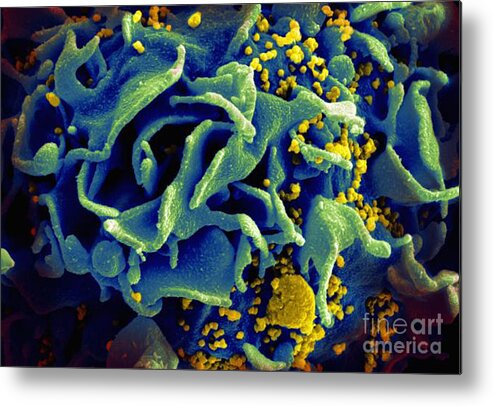 Microbiology Metal Print featuring the photograph Hiv-infected T Cell, Sem by Science Source